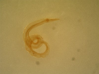 Roup krli pod mikroskopem